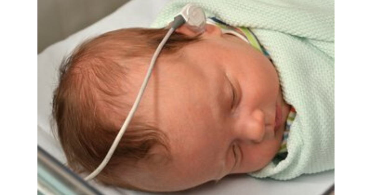 Newborn Hearing Screening Update - British Academy Of Audiology ...